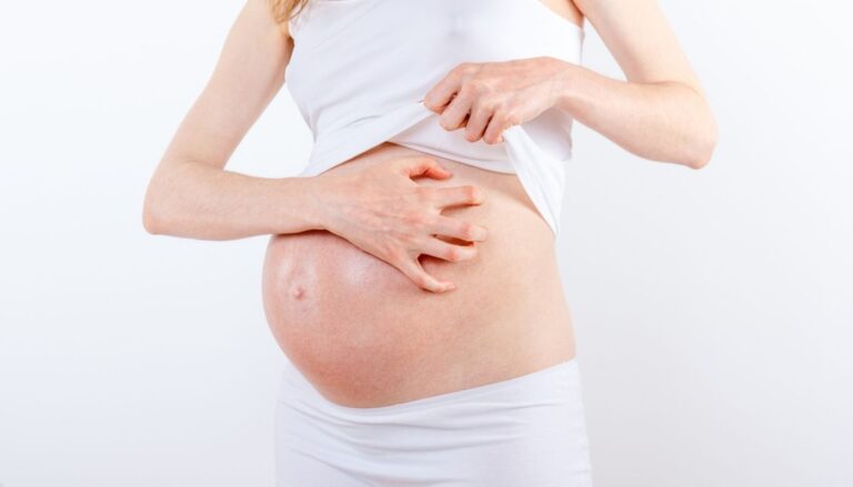 10 Maddede Hamilelikte Kaşıntı