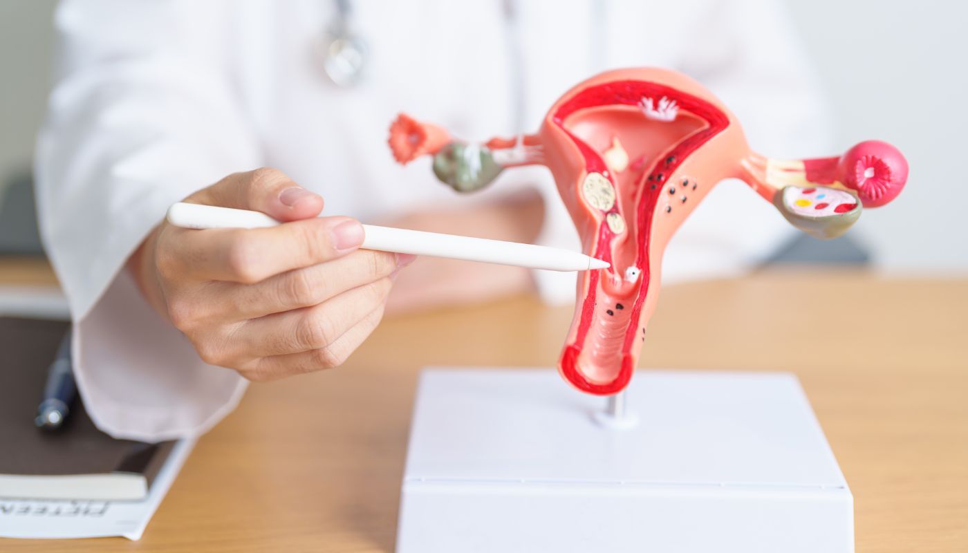 Endometriozis (Çikolata Kisti) Tedavi Edilebilir mi?