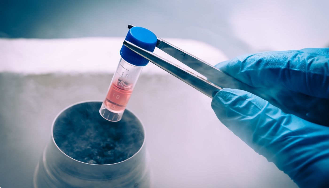 Kısırlık ve Kök Hücre Tedavisi