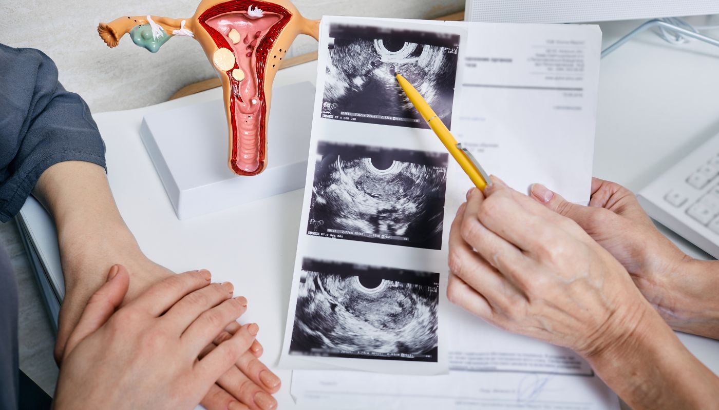 Polikistik Over Sendromu