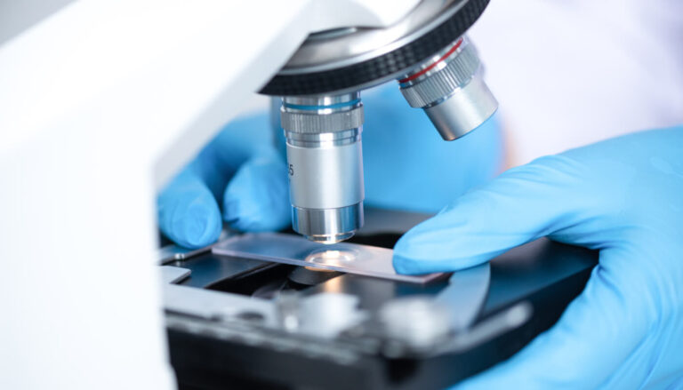 Spermiogram Nedir, Neden Yapılır?